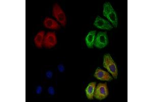 ABIN6259594 and ABIN6274739 staining Hela cells by IF/ICC. (MRPL35 抗体  (Internal Region))