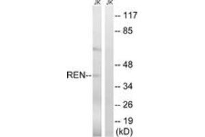 Western blot analysis of extracts from Jurkat cells, using REN Antibody. (Renin 抗体  (AA 207-256))