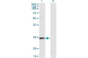 Western Blot analysis of RAB7B expression in transfected 293T cell line by RAB7B monoclonal antibody (M02), clone 1C3. (RAB7B 抗体  (AA 100-199))