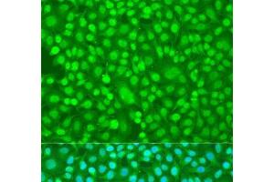 Immunofluorescence analysis of U2OS cells using PER1 Polyclonal Antibody at dilution of 1:100. (PER1 抗体)