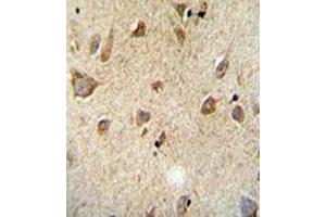 Immunohistochemical staining of formalin-fixed and paraffin-embedded human brain tissue reacted with RET monoclonal antibody  at 1:50-1:100 dilution. (Ret Proto-Oncogene 抗体)