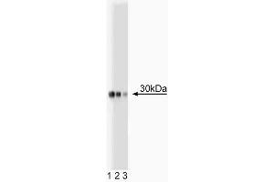 Western blot analysis of Acrp30 on plasma lysate. (ADIPOQ 抗体  (AA 1-247))