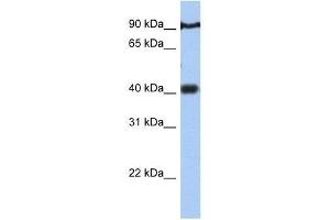 PTOV1 antibody used at 0.