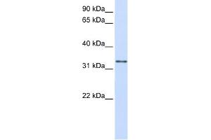 WB Suggested Anti-GPSN2 Antibody Titration:  0. (TECR 抗体  (C-Term))