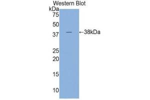 Western blot analysis of the recombinant protein. (Cardiac Troponin T2 抗体  (AA 1-295))