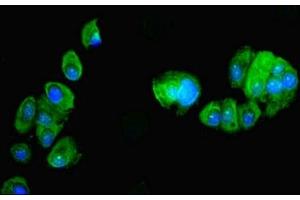 Immunofluorescent analysis of MCF-7 cells using ABIN7162466 at dilution of 1:100 and Alexa Fluor 488-congugated AffiniPure Goat Anti-Rabbit IgG(H+L) (PDRG1 抗体  (AA 1-133))