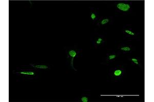 Immunofluorescence of monoclonal antibody to PRKDC on HeLa cell. (PRKDC 抗体  (AA 4019-4128))