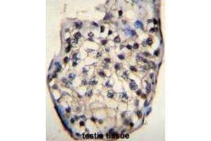 Immunohistochemistry (IHC) image for anti-Outer Dense Fiber of Sperm Tails 3 (ODF3) antibody (ABIN2996385) (ODF3 抗体)