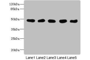 Western Blot All lanes: GCDH antibody at 8 μg/mL Lane 1: Mouse kidney tissue Lane 2: Mouse liver tissue Lane 3: Hela whole cell lysate Lane 4: MCF-7 whole cell lysate Lane 5: LO2 whole cell lysate Secondary Goat polyclonal to rabbit IgG at 1/10000 dilution Predicted band size: 49, 48 kDa Observed band size: 49 kDa (GCDH 抗体  (AA 45-300))