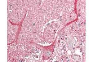Immunohistochemistry (Paraffin-embedded Sections) (IHC (p)) image for anti-Sema Domain, Seven Thrombospondin Repeats (Type 1 and Type 1-Like), Transmembrane Domain (TM) and Short Cytoplasmic Domain, (Semaphorin) 5B (SEMA5B) (AA 350-602) antibody (Biotin) (ABIN2627980)