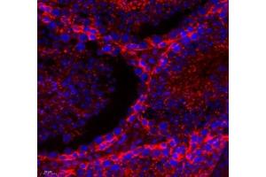 Immunofluorescence (Paraffin-embedded Sections) (IF (p)) image for anti-threonine Synthase-Like 2 (THNSL2) antibody (ABIN7075893)