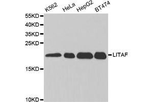 Western blot analysis of extracts of various cell lines, using LITAF antibody (ABIN5973182) at 1/1000 dilution. (LITAF 抗体)