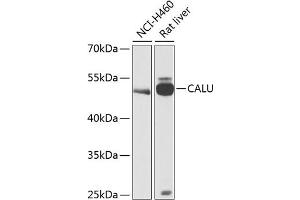 Western blot analysis of extracts of various cell lines, using CALU antibody (ABIN6129532, ABIN6137877, ABIN6137879 and ABIN6216027) at 1:1000 dilution.