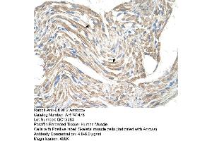 Rabbit Anti-CKMT2 Antibody  Paraffin Embedded Tissue: Human Muscle Cellular Data: Skeletal muscle cells Antibody Concentration: 4. (CKMT2 抗体  (N-Term))