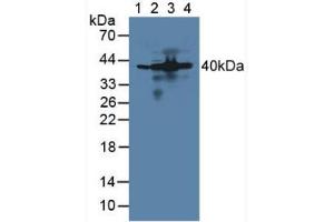 Figure. (AIMP1 抗体  (AA 2-310))