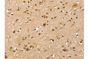 The image on the left is immunohistochemistry of paraffin-embedded Human brain tissue using ABIN7192547(SLTM Antibody) at dilution 1/40, on the right is treated with synthetic peptide.