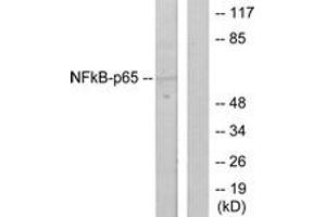 Western blot analysis of extracts from HeLa cells, using NF-kappaB p65 (Ab-536) Antibody. (NF-kB p65 抗体  (AA 502-551))