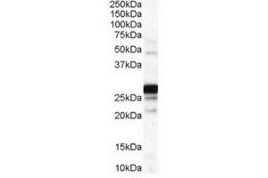 Image no. 1 for anti-Catechol-O-Methyltransferase (COMT) (Internal Region) antibody (ABIN374718) (COMT 抗体  (Internal Region))