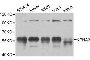 Western blot analysis of extracts of various cell lines, using KPNA3 antibody (ABIN5974559) at 1/1000 dilution. (KPNA3 抗体)