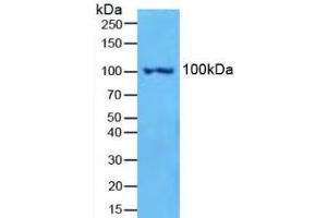 Detection of NFkB2 in Mouse Spleen Tissue using Polyclonal Antibody to Nuclear Factor Kappa B2 (NFkB2) (Nuclear Factor kappa B2 (AA 38-343) 抗体)