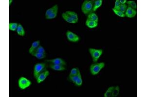 Immunofluorescence staining of HepG2 cells with ABIN7175242 at 1:166, counter-stained with DAPI. (ATP6VD2 (AA 50-295) 抗体)