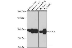 Western blot analysis of extracts of various cell lines using SCYL2 Polyclonal Antibody at dilution of 1:3000.
