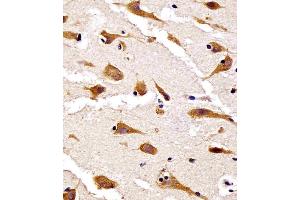 (ABIN6242448 and ABIN6578653) staining RPS27 in human brain tissue sections by Immunohistochemistry (IHC-P - paraformaldehyde-fixed, paraffin-embedded sections). (RPS27 抗体  (AA 5-37))