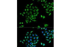 Immunofluorescence analysis of U2OS cells using CYP2C9 Polyclonal Antibody (CYP2C9 抗体)