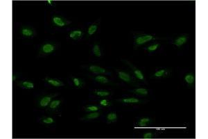 Immunofluorescence of monoclonal antibody to PMS2 on HeLa cell. (PMS2 抗体  (AA 763-862))