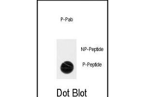 Dot blot analysis of anti-Phospho-ACK1-p Antibody (ABIN389970 and ABIN2839765) on nitrocellulose membrane. (TNK2 抗体  (pTyr518))