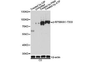 Western blot analysis of extracts of C6 cells, using Phospho-RPS6KA1-T359 antibody. (RPS6KA1 抗体  (pSer363))
