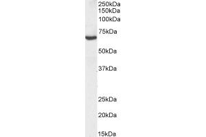 Western Blotting (WB) image for anti-Transforming Growth Factor, beta-Induced, 68kDa (TGFBI) (Internal Region) antibody (Biotin) (ABIN5608784)