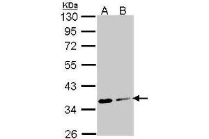 WB Image Sample (30 ug of whole cell lysate) A: Molt-4 , B: Raji 10% SDS PAGE antibody diluted at 1:1000 (ASPA 抗体)