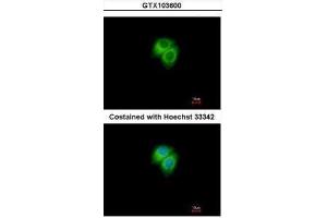 ICC/IF Image Immunofluorescence analysis of methanol-fixed Hep G2, using Adenylate kinase 7, antibody at 1:500 dilution. (Adenylate Kinase 7 抗体)
