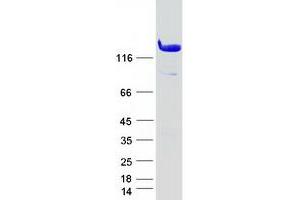 Western Blotting (WB) image for Amphiphysin (AMPH) (Transcript Variant 1) protein (Myc-DYKDDDDK Tag) (ABIN2714670)