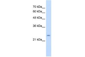 WB Suggested Anti-CHIC1 Antibody Titration:  5. (CHIC1 抗体  (N-Term))