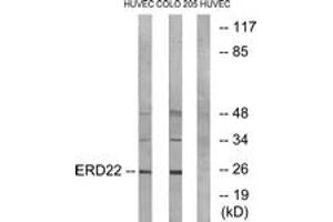 Western blot analysis of extracts from HuvEc/COLO cells, using ERD22 Antibody. (KDELR2 抗体  (AA 81-130))