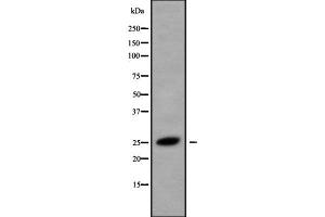 Western blot analysis of CMTM5 using HeLa whole cell lysates (CMTM5 抗体  (Internal Region))