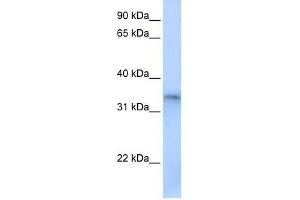 FHL5 antibody used at 0. (FHL5 抗体  (Middle Region))