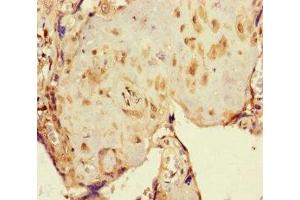 Immunohistochemistry (IHC) image for anti-Nuclear Receptor Subfamily 1, Group H, Member 3 (NR1H3) (AA 1-402) antibody (ABIN7162411)