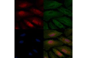 ABIN6256975 and ABIN6275033 staining  cells by IF/ICC. (C1QBP 抗体  (Internal Region))
