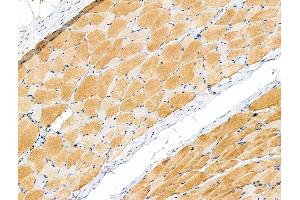 Phospho-PYGL (Ser15) Antibody at 1/100 staining Rat ovarian tissue by IHC-P. (PYGL 抗体  (pSer15))