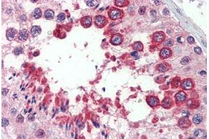 Testis, Human: Formalin-Fixed, Paraffin-Embedded (FFPE) (Reticulon 4 抗体  (AA 501-515))
