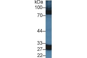 Western Blot; Sample: Rat Spleen lysate; Primary Ab: 1. (CA5A 抗体  (AA 12-219))