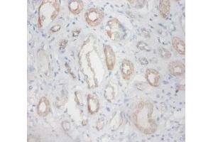 Immunohistochemistry of paraffin-embedded human kidney tissue using ABIN7176559 at dilution of 1:100 (ZFP91 抗体  (AA 1-208))