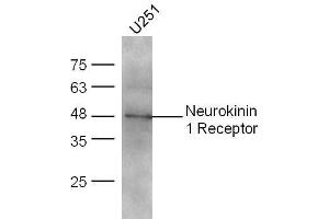 Western Blotting (WB) image for anti-Tachykinin Receptor 1 (TACR1) (AA 2-50) antibody (ABIN724385)
