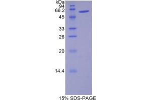 SDS-PAGE analysis of Rat Noggin Protein. (NOG 蛋白)
