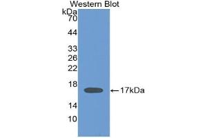 Detection of Recombinant IL2, Human using Monoclonal Antibody to Interleukin 2 (IL2) (IL-2 抗体  (AA 21-153))