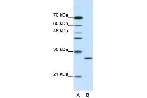 CLIC1 antibody used at 2.