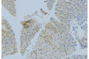 Immunohistochemistry (IHC) image for anti-Fc Fragment of IgE, Low Affinity II, Receptor For (CD23) (FCER2) (C-Term) antibody (ABIN6261699)